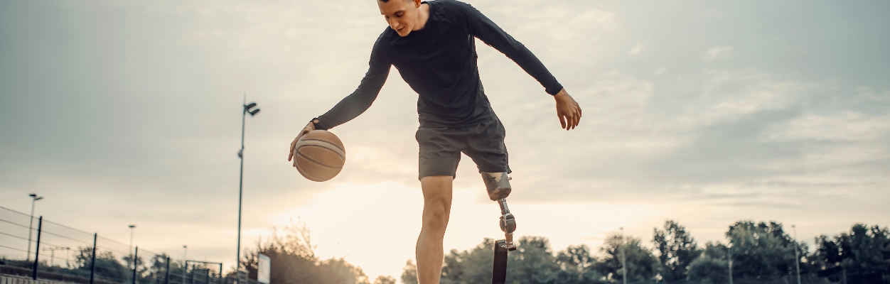 Person with amputation